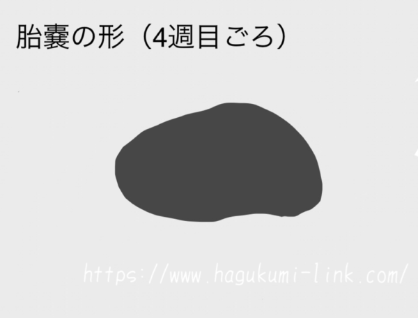 4週目ごろの胎嚢